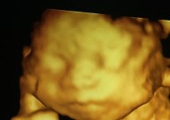 苹果手机哪里可以看片子四维？如何设置？