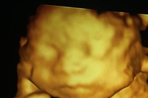 苹果手机哪里可以看片子四维？如何设置？