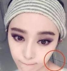 美颜相机效果模糊的原因是什么？  第3张
